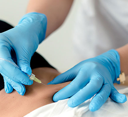 zabieg karboksyterapia